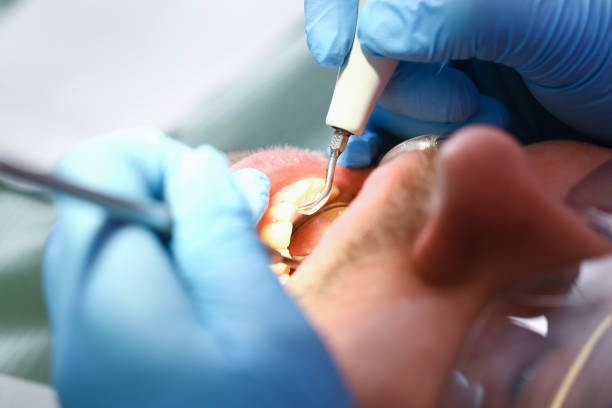 Best Broken Tooth Emergency  in Harahan, LA