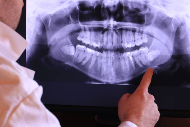 Best Knocked-Out Tooth Emergency  in Harahan, LA
